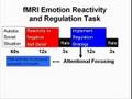 Cognitive Neuroscience of Mindfulness Meditation